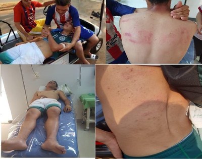 Dirigente deportivo de Hernandarias golpeó brutalmente a jugador de 15 años, denuncian