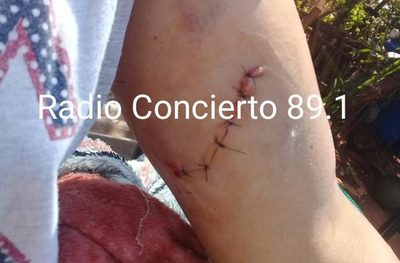 Hombre ataca a su expareja y le deja cortes en el cuerpo