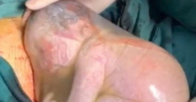Bebé chino salió apurado de la panza materna