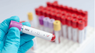 En Paraguay el 53% de los diagnosticados con VIH son adolescentes y jóvenes