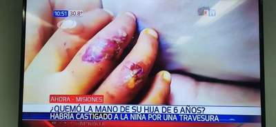 Misiones; prisión preventiva para madre que quemó la mano de su hija