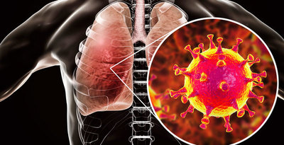 Fiebre, tos y dificultad para respirar, son signos y síntomas del coronavirus
