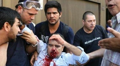 Acosta: "Hasta ahora es como que si no importara lo que pasó el 31M, y eso duele, es muy triste"