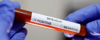 Coronavirus en Paraguay: El Chaco tiene su primer caso confirmado de COVID-19