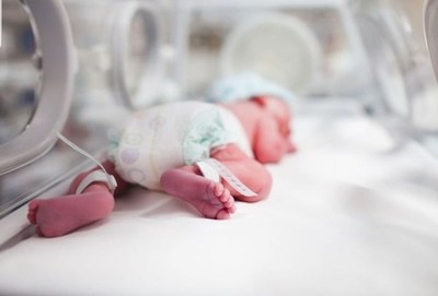 Dos prematuros mueren en PJC por falta de terapia neonatal