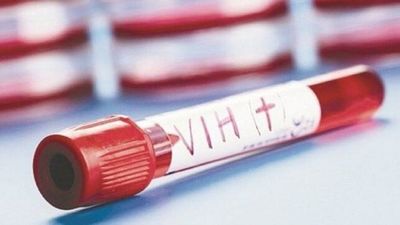 OMS alerta que 73 países corren riesgo de quedarse sin fármacos contra el VIH
